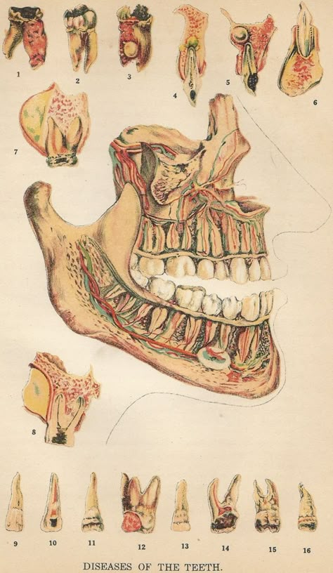 Mandible & Maxillary Anatomy   #bones #bone #tooth #teeth #dental #anatomy #medical #medicine Teeth Anatomy, Medical Drawings, Anatomy Bones, Teeth Art, Dental Anatomy, Science Illustration, Dental Art, Bio Art, Human Figure Drawing