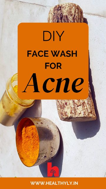 Comedonal Acne, Cystic Acne Remedies, Diy Face Wash, Homemade Face Wash, Acne Soap, Diy Acne, Acne Face Wash, Natural Acne Remedies, Home Doctor