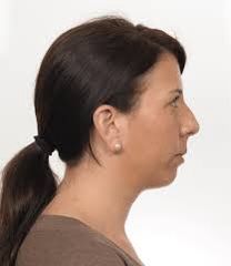 Convex profile includes sloping forehead, slightly prominent brows and large slightly curved nose. Further, people of convex type have a receding chin shape. Receding Chin, Convex Profile, Curved Nose, Minor Character, Hair, Beauty