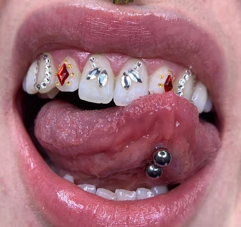 Tooth Gem Ideas Baddie, Tooth Gem Placement, Teeth Gems, Grillz Teeth, Diamond Teeth, Tooth Gems, Tooth Gem, Gold Teeth, Teeth Jewelry