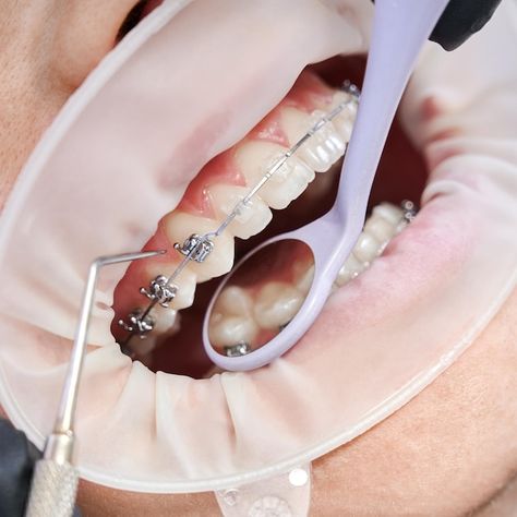 Composite Bonding, Ceramic Braces, Dental Photography, Teeth Straightening, Metal Braces, Family Dentistry, Natural Teeth Whitening, Best Dentist, Dental Services