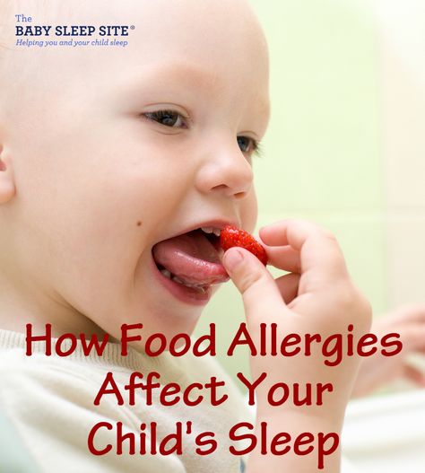 Other Foods That Can Cause Allergies To Babies Gluten Allergy Rash, Food Allergy Rash, Dairy Allergy Symptoms, Baby Food Allergies, Food Allergy Symptoms, Baby Acne, Dairy Allergy, Skin Allergy, Gluten Allergy