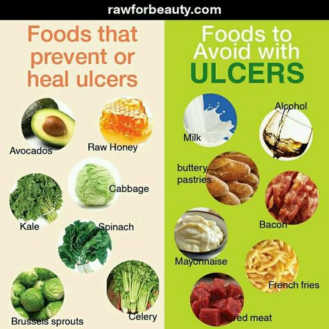 Foods that prevent ulcers and foods to avoid with ulcers Foods For Ulcers, Ulcer Diet, Atkins Diet Plan, Gerd Diet, Cabbage And Bacon, Stomach Ulcers, Things To Eat, Energy Foods, Healing Food