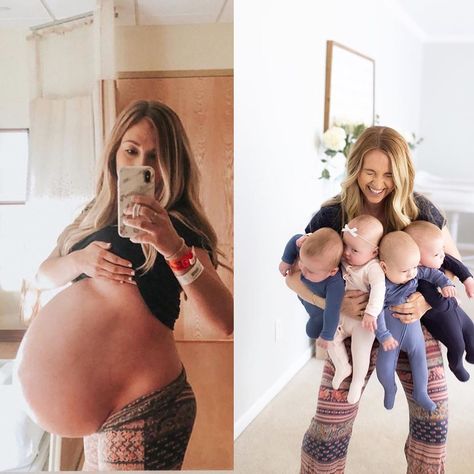 After a series of miscarriages, Lindsay Hay gave birth to four “thriving” babies. Twin Pregnancy Belly, 30 Weeks, Health Topics, Pregnant Belly, Green Juice, Baby Bumps, Getting Pregnant, Pregnancy Photos, Womens Health