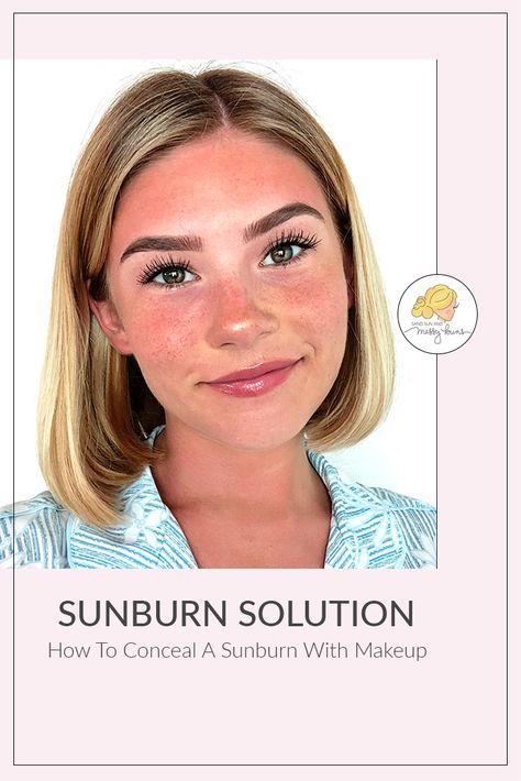 Really helpful video tutorial showing how to cover up sunburn with makeup. #sunburn #makeuptutorial | sandsunandmessybuns.com Sunburn Makeup Look, Sunburnt Makeup Look, Sunburnt Makeup, Sunburn Makeup, Sunburn On Face, Sunburn Face, Sunburnt Face, Burn Makeup, Grey Eye Makeup