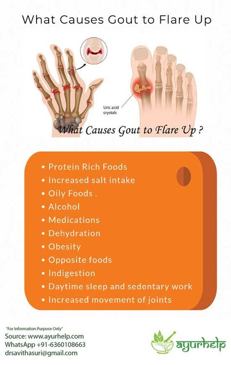 Texts of Ayurveda explain effective natural ayurvedic home remedies which help in gout and also to reduce uric acid levels. These herbal formulae effectively help to reduce joint pain and inflammation. uric acid control medicine (gout medicine ) Table of contents What is Gout in Ayurveda? Causes of Gout – According to Ayurveda Symptoms of […] Uric Acid Crystals, Uric Acid Levels, Ayurvedic Diet, Degenerative Disease, Blood Pressure Medications, Homemade Facials, Protein Rich Foods, Uric Acid, Easy Yoga Workouts