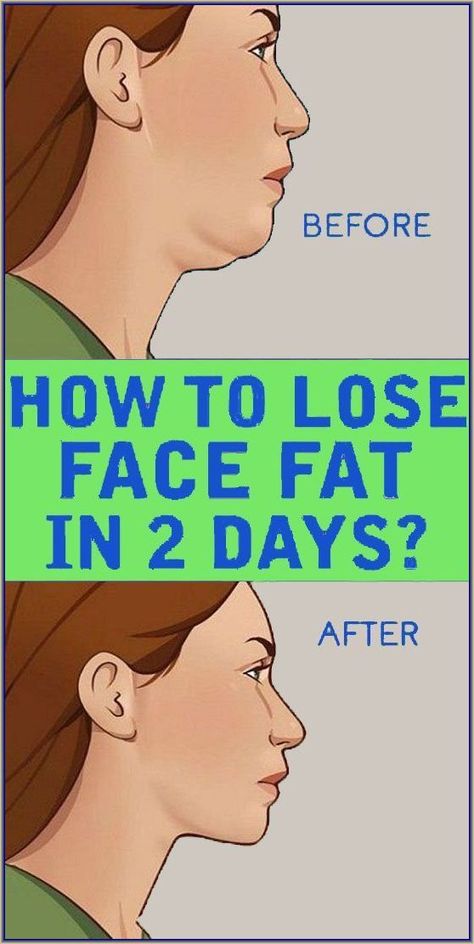 Chin Reduction, Reduce Face Fat, Double Chin Exercises, Chin Exercises, Face Fat, Slimmer Face, Anti Aging Oils, Face Exercises, Facial Exercises