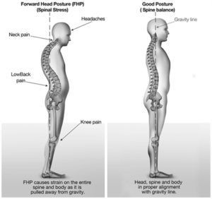 Read about SIMPLE exercises to help correct Forward Head Posture.  Reduce your neck pain and help change your posture! Forward Head Posture Correction, Forward Head Posture Exercises, Better Posture Exercises, Posture Correction Exercises, Neck And Shoulder Exercises, Posture Fix, Text Neck, Neck And Shoulder Muscles, Body Alignment