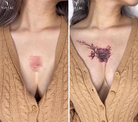 40 Times People Asked To Cover Up Their Scars And This Tattoo Artist Nailed It (New Pics) | Bored Panda Birthmark Tattoo, Tattoo Over Scar, Scar Cover Up, Tattoos To Cover Scars, Scar Tattoo, Tattoo Inspiration Men, Tattoo Cover-up, Cover Up Tattoo, Up Tattoos