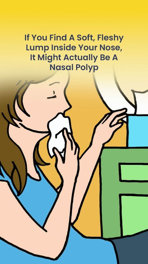 Do you know what nasal polyps are? Find out more about these nasal bumps and learn about the signs and symptoms to look out for. Nasal Polyps, Signs And Symptoms, Do You Know What, The Signs, How To Stay Healthy, Did You Know, To Look, Essential Oils, Signs