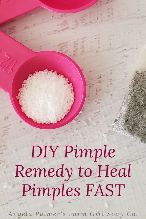 Zit Remedy, Natural Remedies For Pimples, Painful Pimple, Redness Pimple, Dry Out Pimples, Big Pimple, Pimple Cream, Home Remedies For Pimples, Blind Pimple