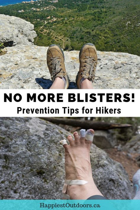 How to prevent blisters while hiking. Keep your feet happy on hikes with these blister prevention tips. Also includes info on how to treat blisters if they do happen. #hiking #blisters #hikingtips How To Treat Blisters, Hiking First Aid Kit, Hiking Training, Prevent Blisters, Backcountry Camping, Backpacking Trip, Hiking Destinations, Backpacking Tips, Backpacking Gear