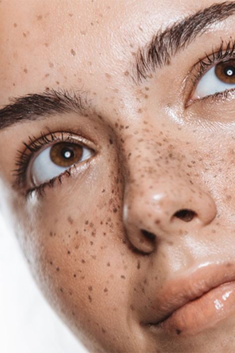 Freckle Makeup, Freckle Tattoo, Tattooed Freckles, Freckles Makeup, Faux Freckles, Tattoo Trend, Important Things To Know, Brown Spots Removal, Beauty Spot