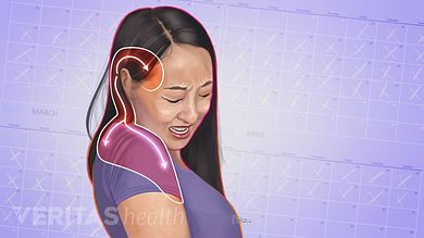 Tmj Headache, Severe Neck Pain, Neck Headache, Forward Head Posture Exercises, Occipital Neuralgia, Headache Causes, Neck And Shoulder Muscles, Neck Problems, Forward Head Posture