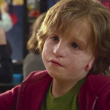 Wonder Auggie, Medical Mission Trip, Jacob Tremblay, Owen Wilson, Perfect Movie, Child Actors, Julia Roberts, Improve Health, Healthy People