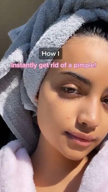 Pimple Problems No More: Your Guide to Pain-Free Skin How To Treat Pimples, Pimple Poppìng, Closed Comedones, Natural Remedies For Acne, Pimple Free Skin, Skin Blackheads, Hot Romance Books, Pimples Remedies, Pimple Patches