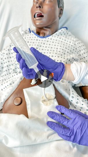 244K views · 1.1K reactions | Peg Tubes Explained! 

🤍PEG tube → percutaneous endoscopic gastrostomy tube

🤍 Device inserted through the abdominal wall directly into the stomach

🤍Provides a means for delivering nutrition, fluids, and medications directly into the stomach for individuals who are unable to consume food orally. 

🤍 Be sure to crush medications finely to avoid clogging the tube (always check if the medication can be crushed!) 

🤍Flush the tube before & after administering feeds or medication to to avoid clogging the tube

🤍 Keep the head of the bed (HOB) elevated during & after feedings to reduce the risk of aspiration

#nursing #nursingschool  #nurse #nclex #medsurg #nursingmajor #nursingnotes #nclextips #rn | Nurse In The Making Nurse In The Making, Gastrostomy Tube, Nursing Major, Peg Tube, Med Surg, Feeding Tube, Nursing Notes, Nclex, Nursing School