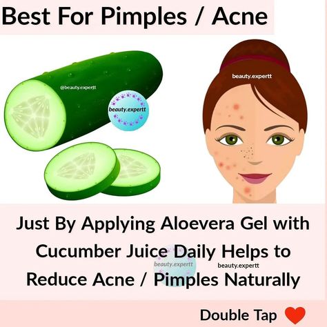 Overnight Remedies, Beginner Skin Care Routine, To Remove Blackheads, Pimples Overnight, Spf Face, Clear Healthy Skin, Natural Skin Care Remedies, Natural Face Skin Care, Good Skin Tips