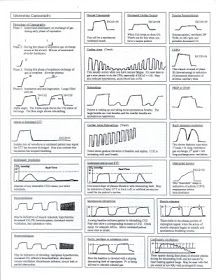 Respiratory Therapy Cave: Capnography Cheat Sheet Respiratory Therapy Notes, Respiratory Therapist Student, Anesthesia School, Respiratory Therapy Student, Emt Study, Paramedic Student, Vet Tech School, Nurse Anesthesia, Nursing Cheat Sheet