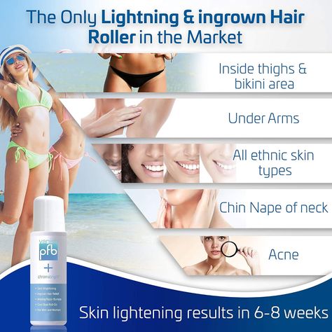 PFB Vanish + Chromabright for Ingrown Hair and Skin Lightening in ONE! 93g: Amazon.co.uk: Beauty Pfb Vanish Chromabright, Pfb Vanish, Neck Acne, Razor Bump, Treat Ingrown Hair, Hair Roll, Tend Skin, Dark Spot Remover, Skin Lightener