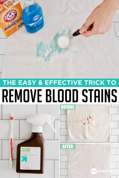 Get Blood Out Of Clothes, How To Get Blood Out Of Clothes, Remove Blood Stains From Clothes, Removing Blood Stains From Clothes, Remove Blood Stains, How To Remove Blood Stains From Clothing, How To Remove Blood Stains, Removing Blood Stains, How To Remove Blood From Fabric