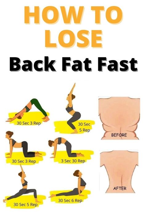 Lose Back Fat Fast, Lose Arm Fat Fast, Lose Back Fat, Lose Arm Fat, Armpit Fat, Back Fat Workout, Skin Tags, Back Fat, Weight Workout Plan