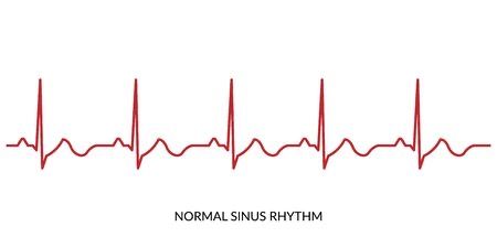 Sinus Rhythm, Nursing School Graduation Pictures, Normal Sinus Rhythm, Nursing School Graduation, Graduation Pictures, Tattoos Ideas, School Graduation, Nursing School, Art Work