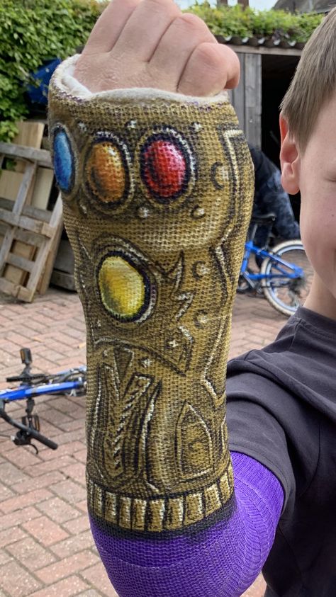 Thanos cast Arm Cast Painting, Cast Art Arm, Halloween Cast, Cast Decoration, Arm Cast, Cast Art, Broken Arm, Plaster Cast, Picture Prompts