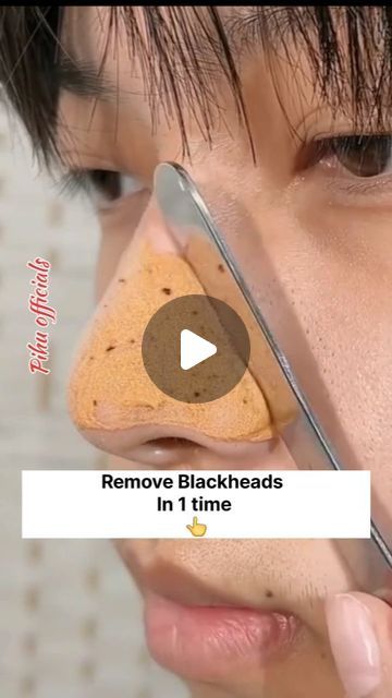 How To Remove Black Heads, Black Head Removal Video Nose, Black Head Removal, Fruits For Glowing Skin, Black Head Remover, How To Remove Blackheads, Home Remedies For Pimples, Blackhead Remedies, To Remove Blackheads