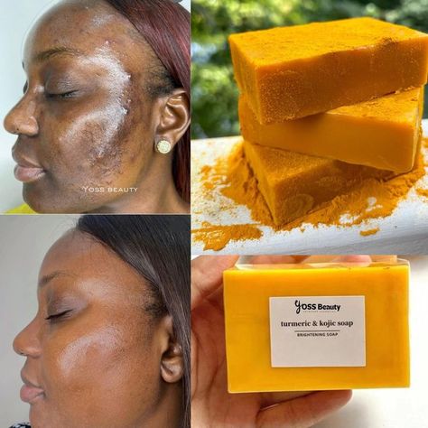 Soap For Dark Spots, Glowing Body Skin, Diy Turmeric Face Mask, Organic Turmeric Powder, Orange Soap, Extremely Dry Skin, Turmeric Soap, Natural Acne Remedies, Face Soap