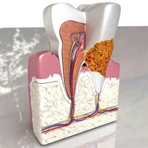 Tooth Model Project, Teeth Structure, Tooth Surfaces Dental, Tooth Surfaces, Dental Images, Dental Plaque, 3d Studio, Dental Clinic, Model Making