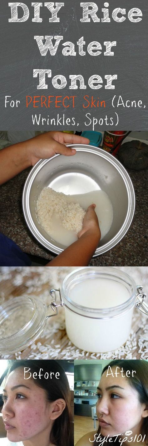 Teeth Nails: Get the most perfect skin with this super easy ric... Diy Rice Water, Rice Water Toner, Make Up Diy, Easy Rice, Rice Water, Younger Skin, Beauty Remedies, Skin Remedies, Beauty Recipe