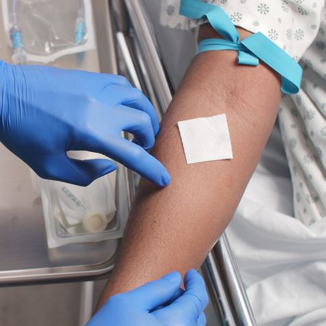 This is an example of vein marking. When you palpate a good vein, place an alcohol pad at the top of where you feel it best, with the corners lined up in the direction of the vein. Hold it in place while cleansing the site, and you’ll be able to find your spot again! Iv Cannulation Nursing Students, Starting An Iv Nursing, Iv Cannulation, Iv Start, Nurse Video, Memes Nursing, Iv Insertion, Nursing Videos, Muzică Rock