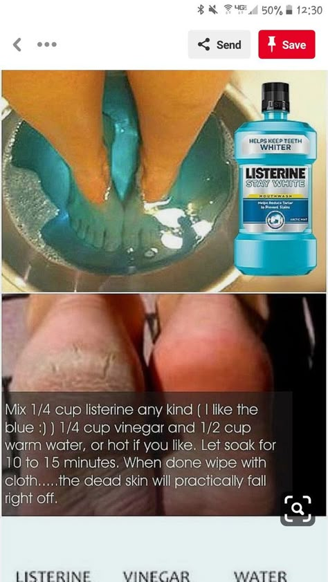 Homemade Foot Cream, Dry Feet Remedies, Foot Soak Recipe, Feet Remedies, Diy Pedicure, Natural Skin Care Ingredients, Skin Care Ingredients, Natural Skin Care Remedies, Skin Care Diy