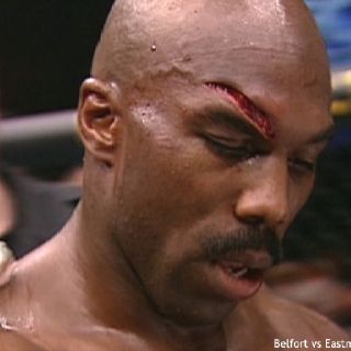 Marvin Eastman After Being Fastly Mauled by Vitor Belfort - One of Nastiest cuts even in MMA Injury Makeup, Mma Videos, Gore Makeup, Broken Nose, Makeup Humor, Face Cut, White Candle, Stage Makeup, Like A Cat