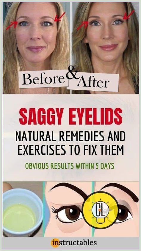 Natural Remedy for Sagging Eyelids-You Will See Results in 2 Minutes! Fix Droopy Eyelids, Sagging Eyelids, Droopy Eyelids, Eye Makeup Application, What Is Health, Woman Health, Healthy Life Hacks, Health Plus, Eyeliner Styles