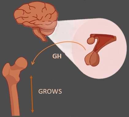 Chaos training (H. I.I.T ) for increasing G.H/ height -GTWSL Height Maxxing, Height Increase Exercise Men, 6ft6 Method For Height, Height Increase Food, Height Increase Exercise, Height Exercises, Grow Height, Height Exercise, Drama Journal