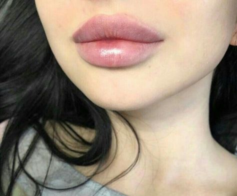 Perfect Features, Lips Inspiration, Face Fillers, Lip Tips, Perfect Nose, Doll Eye Makeup, Facial Aesthetics, Lip Filler, Lip Shapes