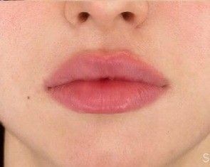 Ariana Grande Lip Fillers, Natural Overlined Lips, Heavy Bottom Lip, Lips Claim, Glossy Lips Aesthetic, Overlined Lips, Bigger Lips, Thick Lips, Lips Aesthetic