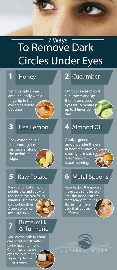 Ways To Remove Dark Circles Under Eyes

1
1. Honey
Simply apply a small amount lightly with a fingertip to the eye areas before bedtime.

2. Cucumber- 
Cut thick slices of cold cucumbers and lay them over closed eyes for 15 minutes up to 3 times per day.

3. Use Lemon
Soak cotton balls in cold lemon juice and rest several along the periorbital ridge.

UNDER EYE DARK REMOVE TIPS || EYE BEAUTY TIPS || FACE CARE TIPS
 #TOPBEAUTYMAKEUPSTIPS
#UNDEREYEDARKREMOVETIPS || #EYEBEAUTYTIPS Dark Eyes Remedies, Almond Oil For Dark Circles, How To Get Rod Of Dark Circles Under Eyes, How To Get Rid Of Dark Eyelids, Dark Undereye Circles Remedies, How To Fix Dark Circles Under Eyes, Undereye Darkness Remedy, Eyebags Remedy Under Eyes, Eye Bags Remedy