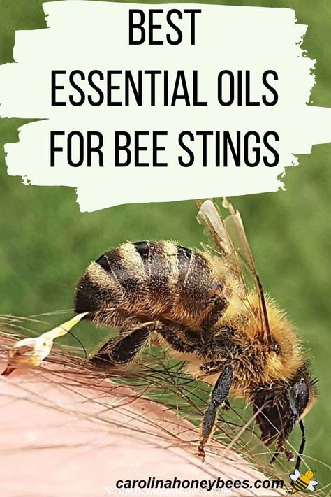 Honey bee stinger in skin. Best essential oils for bee stings. Oils For Bee Stings, Essential Oil For Wasp Sting, Essential Oils For Bee Stings, Bee Sting Essential Oil, Bee Sting Remedies, Bee Sting Remedy, Bee Sting Relief, Wasp Sting Remedy, Hornet Sting