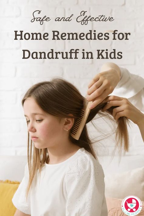 How To Get Dandruff Out Of Hair, Best Dandruff Remedy, Homemade Remedies For Dandruff, Hair Hacks For Dandruff, Dandruff Remedy Severe, How To Prevent Dandruff, Natural Remedies For Dandruff, Dandruff Home Remedies, How To Reduce Hair Fall And Dandruff