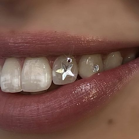 Classic Star. Tooth gems by Dazzle Teeth. Crystals and Gold services available at our Christchurch studio in New Zealand. Qualified and Insured Tooth Gem Technician. Star Teeth Gem, Small Tooth Gem, Tooth Gems Star, Teeth Jewelry Tooth Gems, Teeth Crystals, Star Tooth Gem, Teeth Gens, Tooth Gem Aesthetic, Teeth Jewels