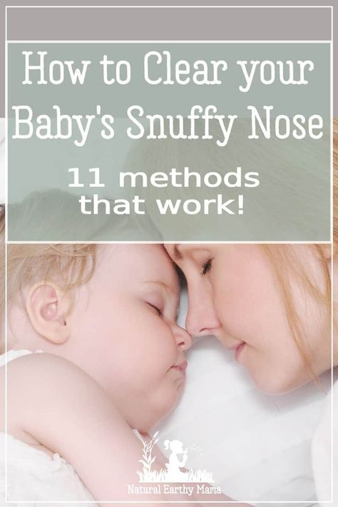 Clearing your baby's nose when they have a cold doesn't have to be difficult with these natural home remedies to clear a stuffy nose #baby #infanthealth #newborn #parenting #naturalhealth #winter #naturalearthymama via @naturalearthymama Newborn Stuffy Nose, Toddler Stuffy Nose, Stuff Nose Remedies, Toddler Runny Nose, Baby Runny Nose, Toddler Cold Remedies, Sick Baby Remedies, Baby Cold Remedies, Baby Stuffy Nose