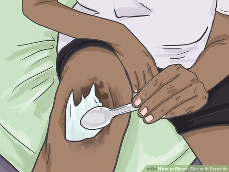 How To Bleach Skin, Bleach Skin, Dark Patches On Skin, Bleaching Your Skin, Dark Inner Thighs, Face Mask Cream, Skin Lightening Diy, Peroxide Uses, Body Bleaching