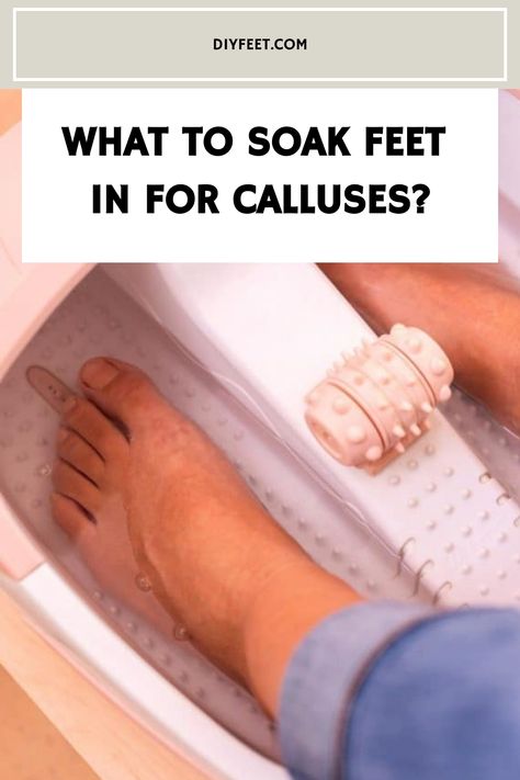 What to Soak Feet in For Calluses? Remove Calluses On Feet Remedies, Diy Callus Remover, Sweaty Feet Remedy How To Get Rid, Diy Foot Soak For Dry Feet Heels, How To Remove Calluses From Foot, Foot Scrub Diy Exfoliating, Calloused Feet Remedy, How To Get Rid Of Calluses On Feet Fast, Calluses On Feet Remedies