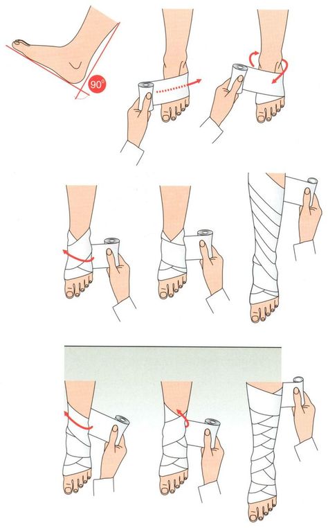 Bandage Arm Aesthetic, Bandage Medical, Medical Drawings, Studera Motivation, First Aid Tips, Trening Sztuk Walki, Self Defence Training, Make A Tie, Survival Skills Life Hacks