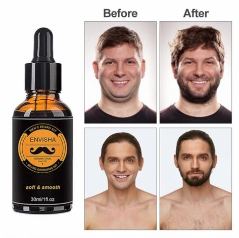 50% OFF! Free Shipping + 20% OFF after Subscribing! RECEIVE UP TO 70% OFF! Product: https://prestigepeakpantry.shop/ultimate-beard-growth-grooming-kit/ Website: https://prestigepeakpantry.shop Beard Grooming Kit, Beard Growth Kit, Essential Oil Brands, Mens Beard Grooming, Beard Growth Oil, Beard Game, Men Beard, Beard Kit, Grow Beard