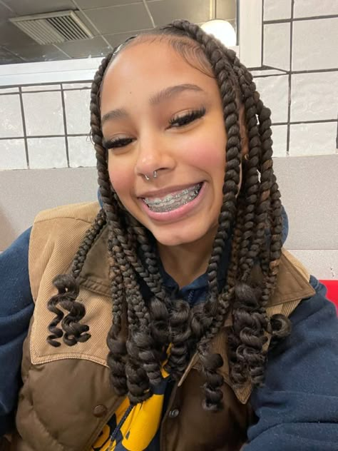 Pretty Girls With Braces Brown Hair, Clear Braces Aesthetic, Braided Hairstyles For White Women, Hairstyles For White Women, Fake Braces, Braided Hairstyles For School, Braces Tips, Cute Braces, Inverted Bob Hairstyles