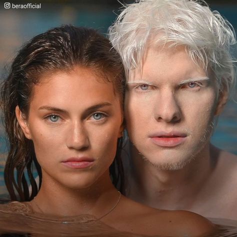 Albino Model, Diversity Inclusion, His Eyes, To The World, Your Eyes, Beautiful People, Boy Or Girl, Milk, Human